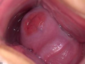 Valentina Nappi gape menutup vagina spekulum