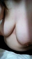 40F Payudara Kendor