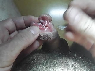 피어싱 subincision